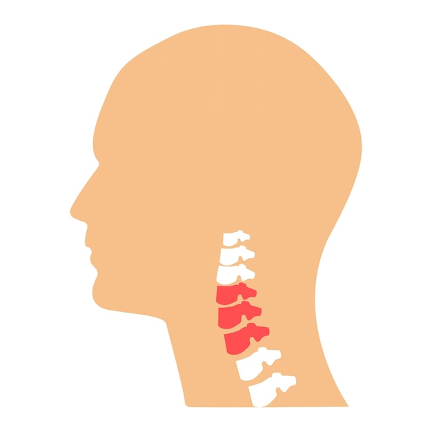 Vetor dor nas vértebras cervicais punho inflamado artrite reumatismo lesão no pescoço