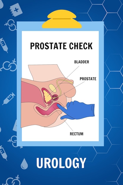 Vetor em branco, de, médico, verificar, próstata, em, vetorial, ilustração
