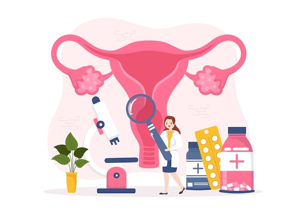 Vetor endometriose com condição em que o endométrio cresce fora da parede uterina em mulheres na ilustração