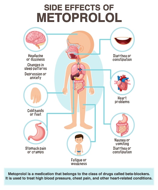 Estilo de desenho animado do diagrama de anatomia humana dos efeitos colaterais do metoprolol