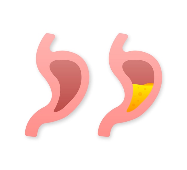 Estômago humano anatomia do sistema digestivo saudável e insalubre