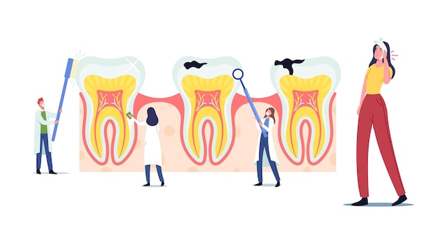 Estomatologia, conceito de odontologia. minúsculos dentistas personagens limpando, tratando enorme dente insalubre com cárie. os médicos trabalham juntos escovando e limpando a placa. ilustração em vetor desenho animado