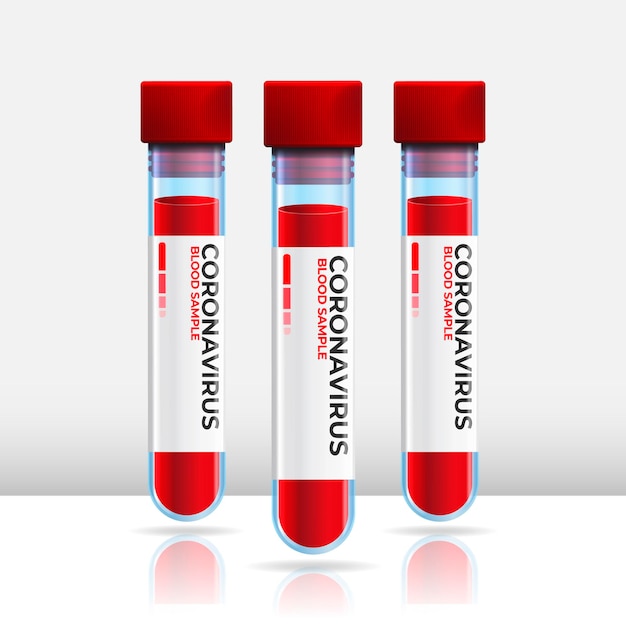 Exame de sangue de coronavírus em tubos
