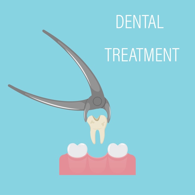 Extração de dente dentário. Exodontia. O dente da pinça dentária. Instrumento odontológico profissional.