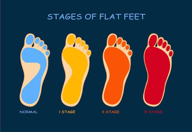Vetor fases de pés chatos