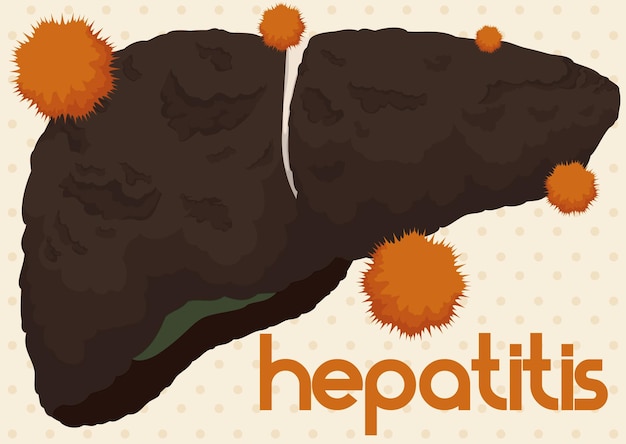 Fígado sob ataque do vírus da hepatite