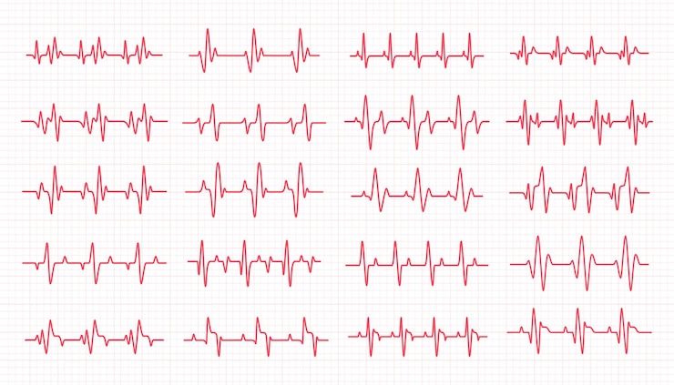 Vetor gráfico de ritmo cardíaco verificando seu batimento cardíaco para diagnóstico