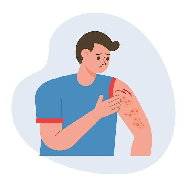 Homem a coçar a mão Comichão alérgico inflamação da pele vermelhidão e irritação