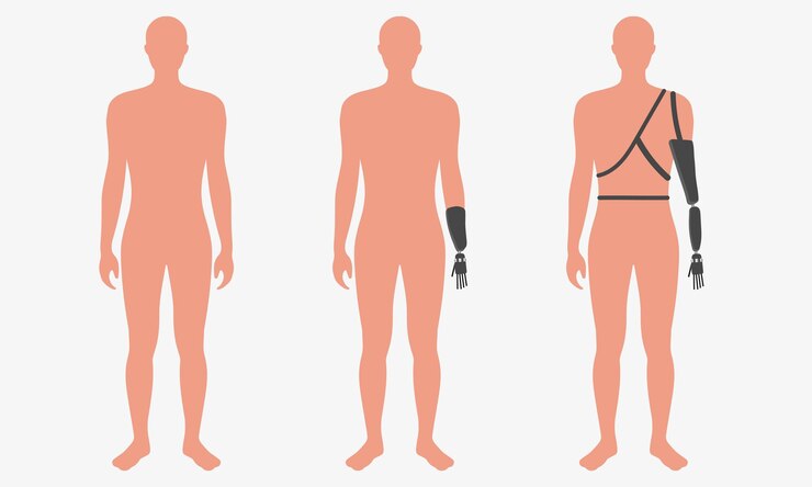 Vetor homem com deficiência que usa um exoesqueleto inovador