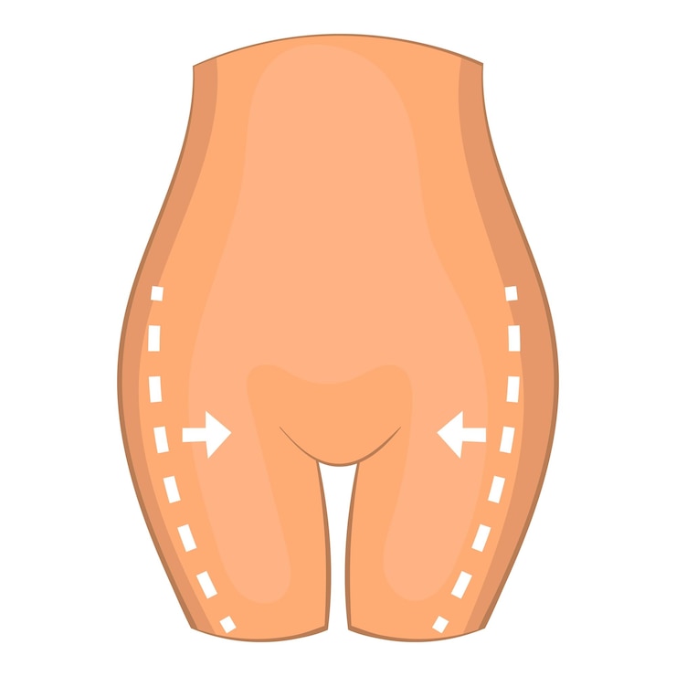 Vetor ícone de cirurgia plástica da coxa ilustração de desenho animado de ícone vetorial de correção de cirurgia corporal para design web