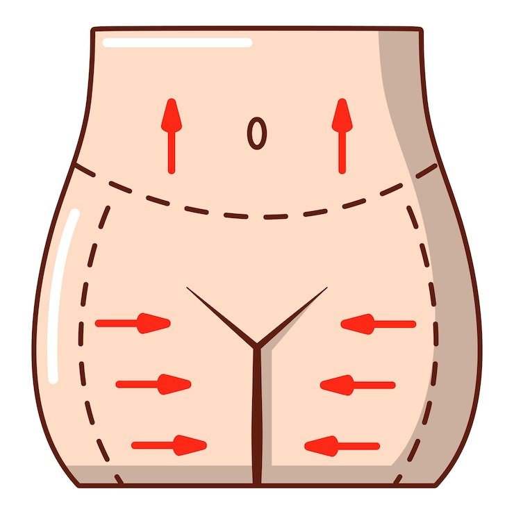 Vetor ícone de lipoaspiração de quadris ilustração de desenho animado do ícone vetor de lipoaspiração de quadris para web