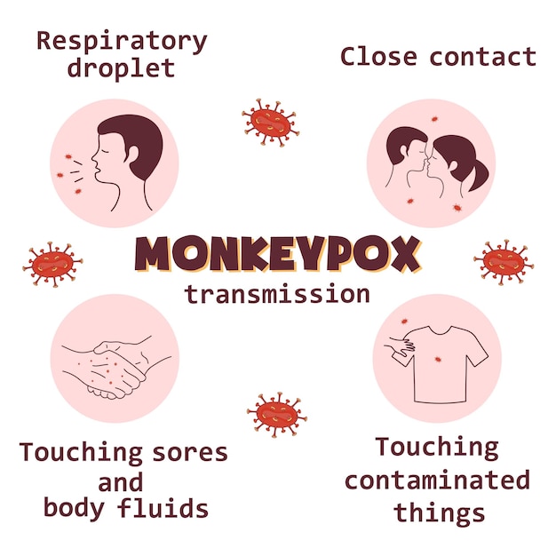 Ícones de infográficos de transmissão de vírus monkeypox informando as pessoas sobre uma doença infecciosa