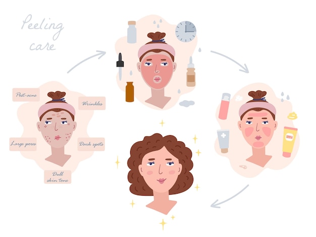 Ilustração da aplicação de peeling para o rosto menina antes e depois do procedimento