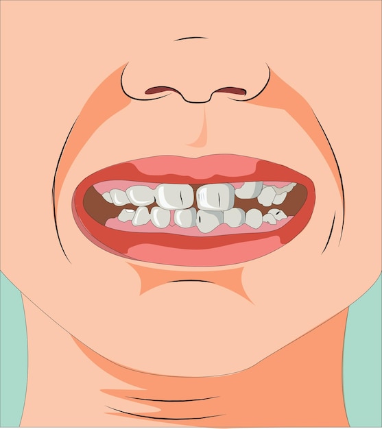 Ilustração de boca humana mostrando dentes e nariz