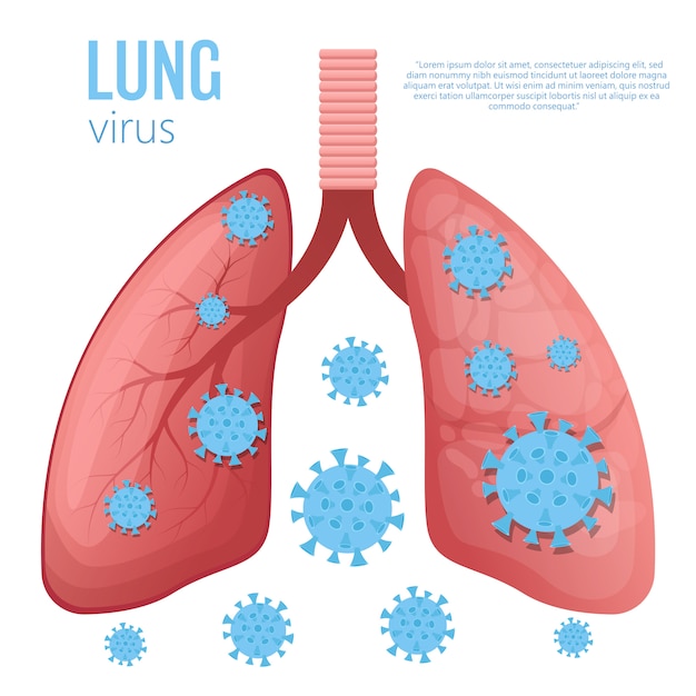 Ilustração de doença pulmonar em fundo branco