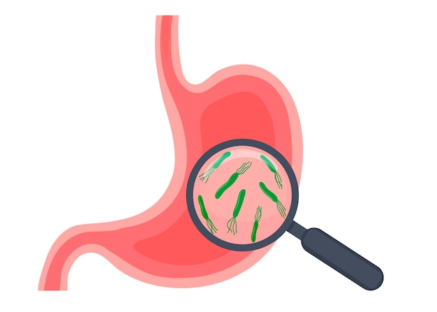 Ilustração de um estudo do estômago da lupa da bactéria helicobacter pylori