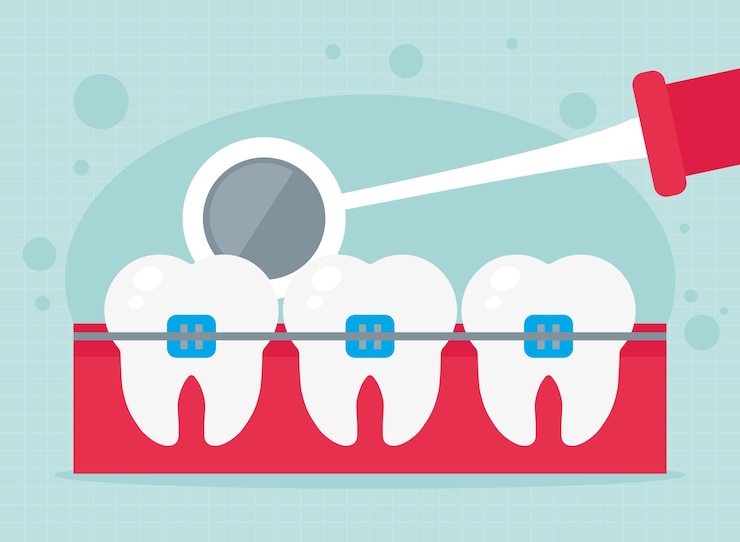 Vetor ilustração do espelho dental
