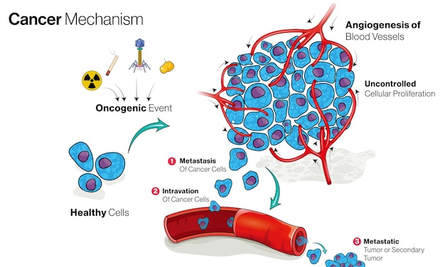 Vetor ilustração do mecanismo de crescimento do cancro proliferação angiogênese proliferação