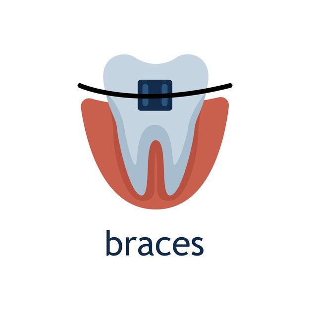 Vetor ilustração em vetor plana de um dente com aparelho