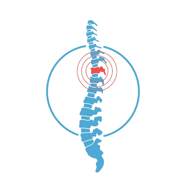 Vetor ilustração em vetor plana isolada logotipo da coluna humana. símbolo do ícone de vértebra. conceito de escoliose