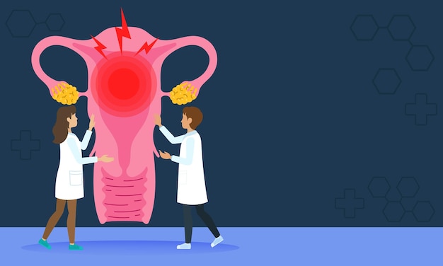Ilustração médica da dor uterina e diagnóstico de endometriose