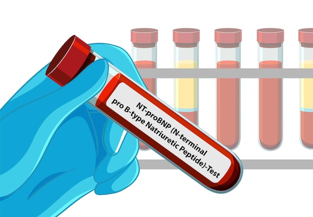 Ilustração Médica de Exames de Sangue