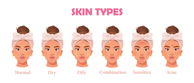 Ilustração vetorial com coleção de tipos de pele e nomes isolados em fundo branco
