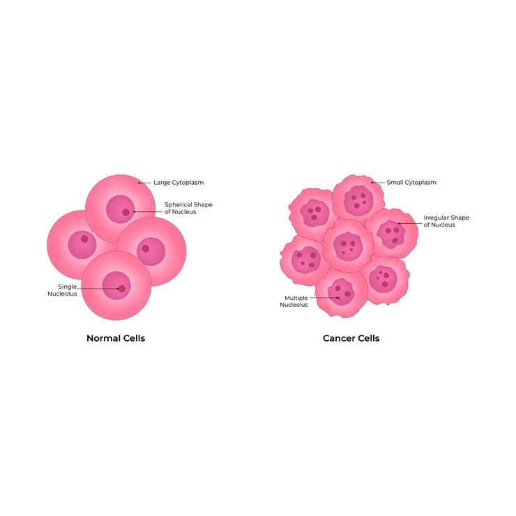 Vetor ilustração vetorial da estrutura das células normais e das células cancerígenas