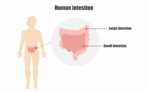 Vetor ilustração vetorial do conceito de medicina de órgão do intestino humano