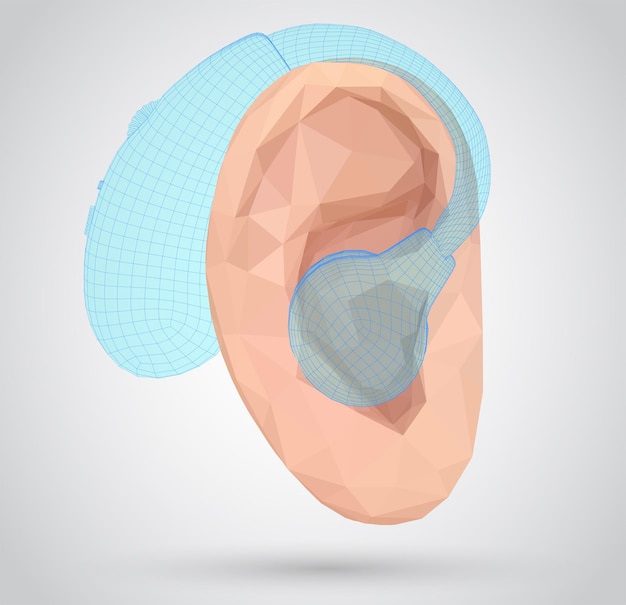 Vetor implantação de cirurgia plástica de tratamento auditivo de ouvido humano vetorial