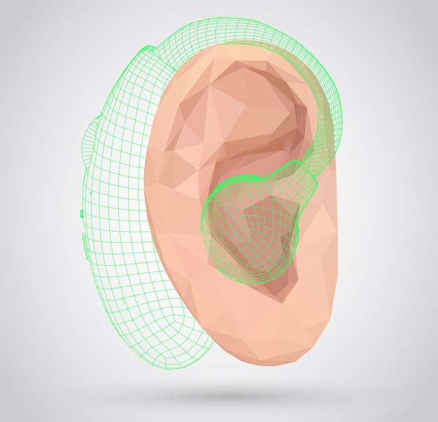 Vetor implantação de cirurgia plástica de tratamento auditivo de ouvido humano vetorial