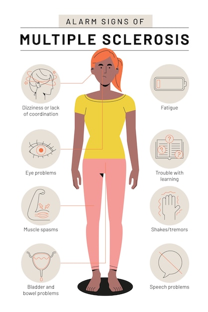 Vetor infográfico de esclerose múltipla de design plano desenhado à mão