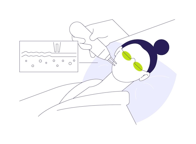 Laser peels conceito abstrato ilustração vetorial médico faz laser peels para mulher trabalhador da medicina