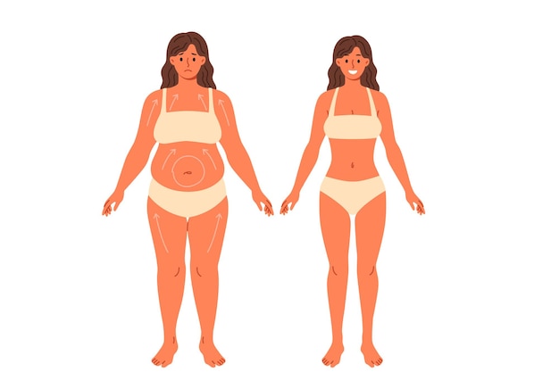 Liposucção para excesso de peso bela mulher posando em roupa interior antes e depois da cirurgia