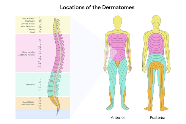 Vetor localização dos dermatomas