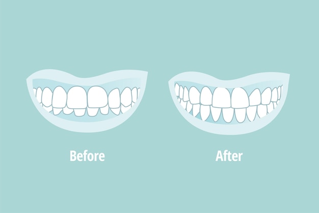 Má oclusão depois e antes da ilustração vetorial de problemas dentários conceito de atendimento odontológico