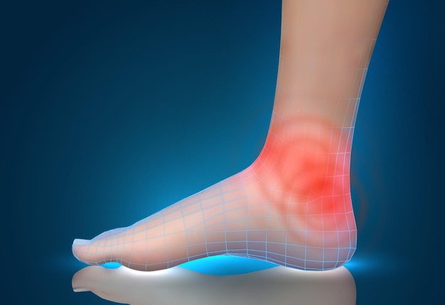 Manchas de pés humanos vetoriais de elemento pronto para dor para medicina e ortopedia