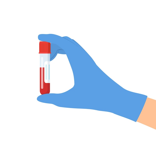 Mão do médico segurando um tubo de ensaio com sangue