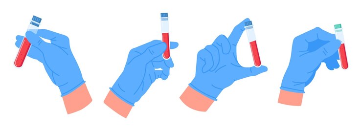 Vetor mãos de trabalhador de laboratório segurando amostras de sangue mãos de médicos com tubos de teste de sangue conjunto de ilustrações de vetores planos tubos de ensaio de sangue em mãos de assistente de laboratório