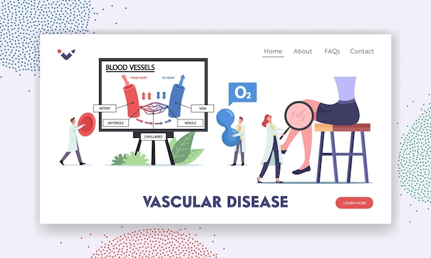 Modelo de página inicial de doença vascular. personagens de minúsculos médicos que apresentam a circulação sanguínea em infográficos de veias e vasos arteriais. perna com malha capilar. ilustração em vetor desenho animado