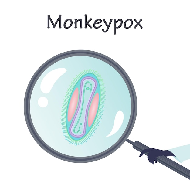 Monkeypox exibido em uma lupa