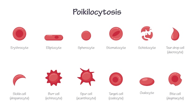 Vetor morfologia da poikilocitose dos eritrócitos, dos glóbulos vermelhos e dos glóbulos vermelhos