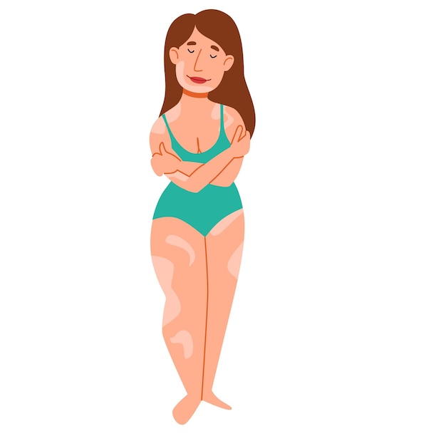 Mulher gorda europeia com vitiligo A garota se abraça