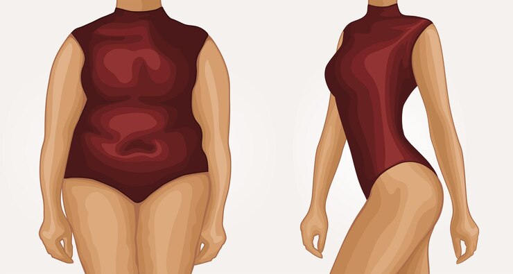 Vetor o corpo de uma garota gorda antes de treinar, fazer dieta e depois de trabalhar em si mesma. estilo realista