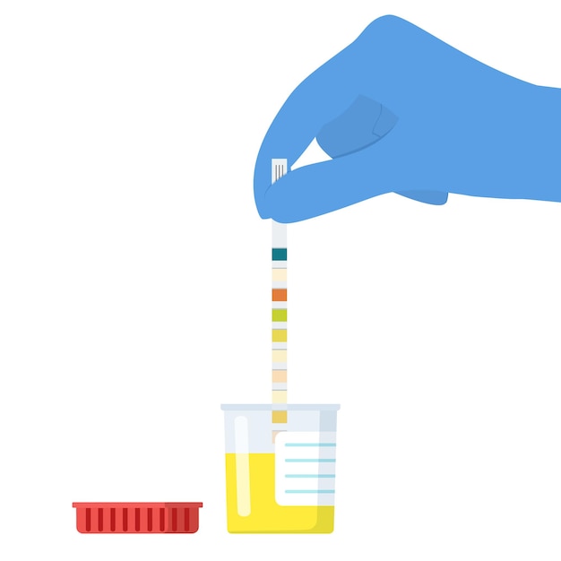 O médico usa uma tira de teste de urina