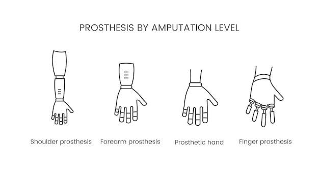 O nível de amputação do braço ícone de linha vetorial de braço protético