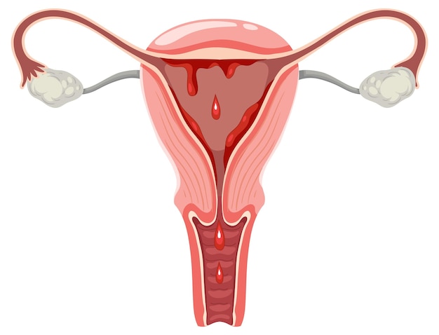 Vetor o útero e os ovários com sangue