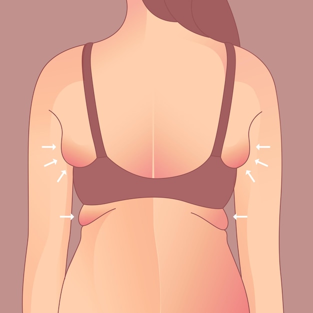 Vetor pele enrugada nas axilas com gordura nas axilas, remoção de pele flácida. transformação da forma do corpo da mulher, fat to fit.