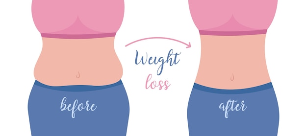 Perda de peso antes e depois Corpo gordo e magro de mulher Figura feminina antes de perder peso e depois Cintura de menina obesa e esbelta Ilustração em vetor plana