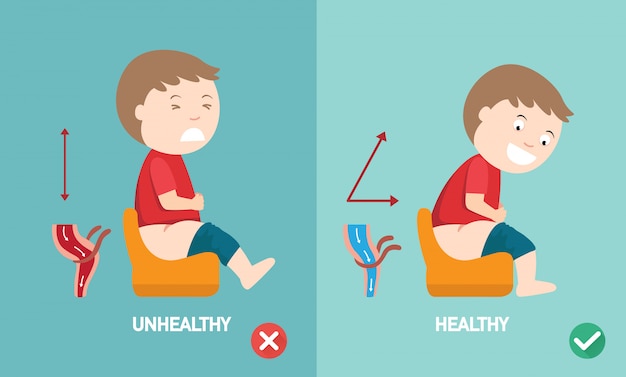 Posições saudáveis ​​versus saudáveis ​​para defecar